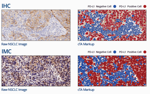 Comparison of Multiplexed Imaging Mass Cytometry with Monoplex Immunohistochemistry in FFPE Tissue