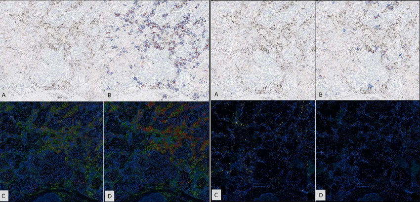 A Digital Assay to Streamline PD-L1 IHC: Published in Scientific Reports